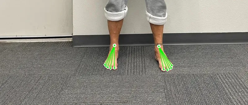 Robot-drawn front profile toes