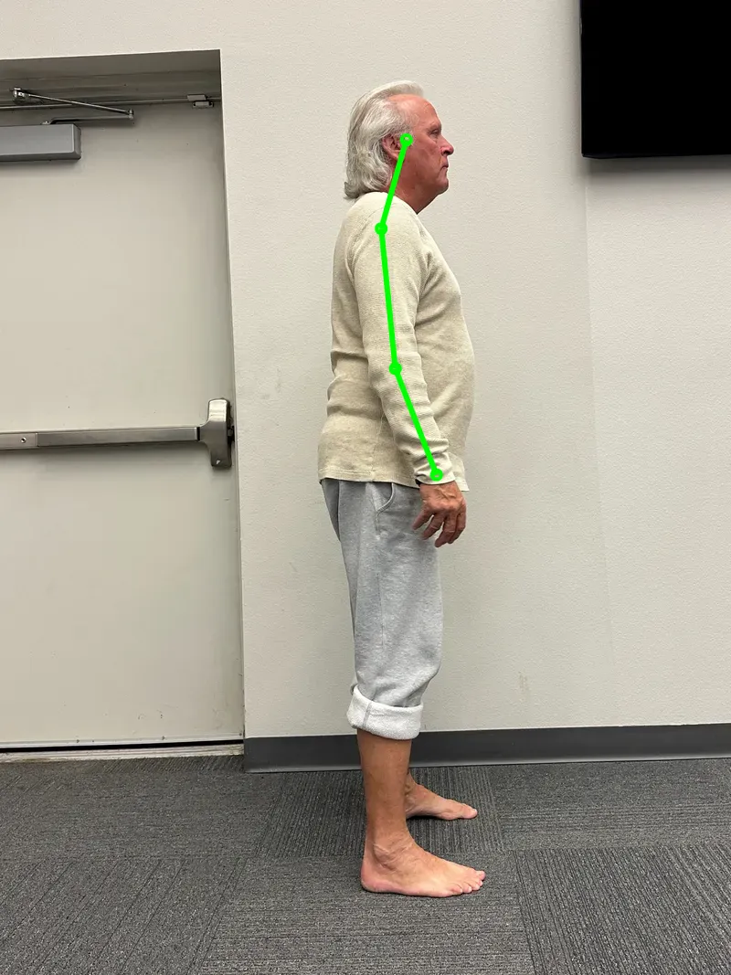 Robot-drawn right profile ear align