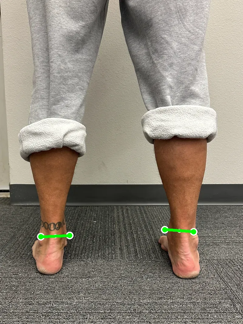 Robot-drawn back ankle profile