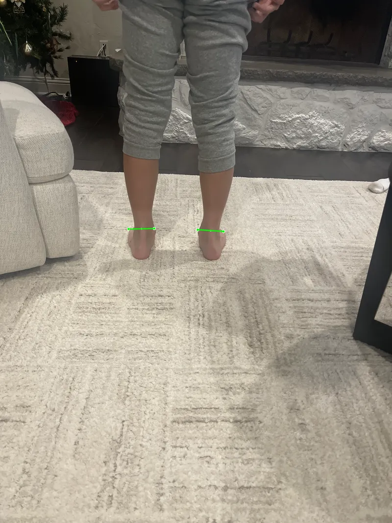 Robot-drawn back ankle profile